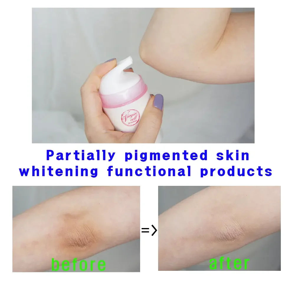 Arm skin before and after using whitening cream for pigmentation, showing visible improvement.